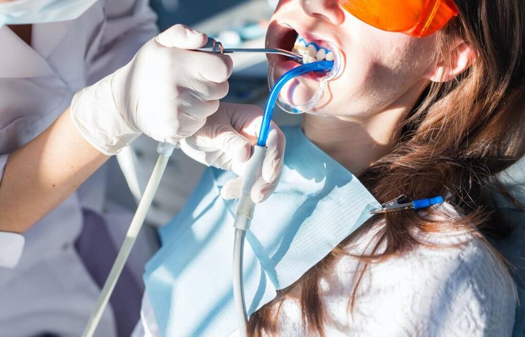 Teeth whitening procedure close-up