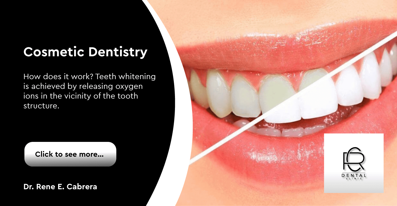 Cosmetic Dentistry in Kendall Dentist in Kendall 2020