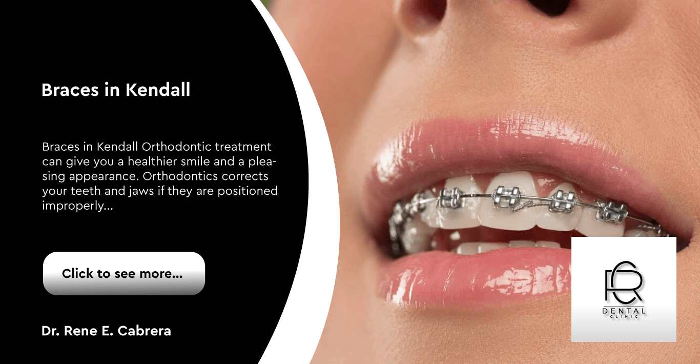 Braces in Kendall in Kendall Dentist in Kendall